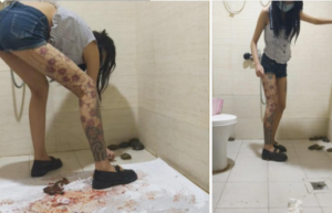 喷血的小乌龟，感冒小薇屠杀乌龟-97LZTD-36610